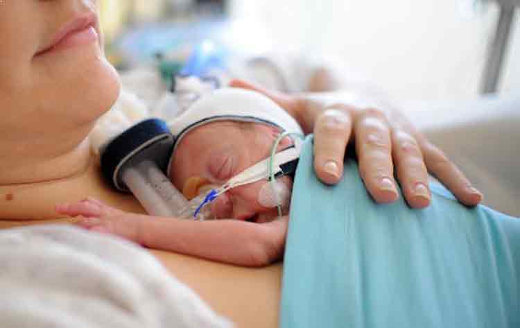 Parto-prematuro1